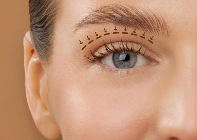 Is Blepharoplasty in Dubai the Right Move for Your Eyes?